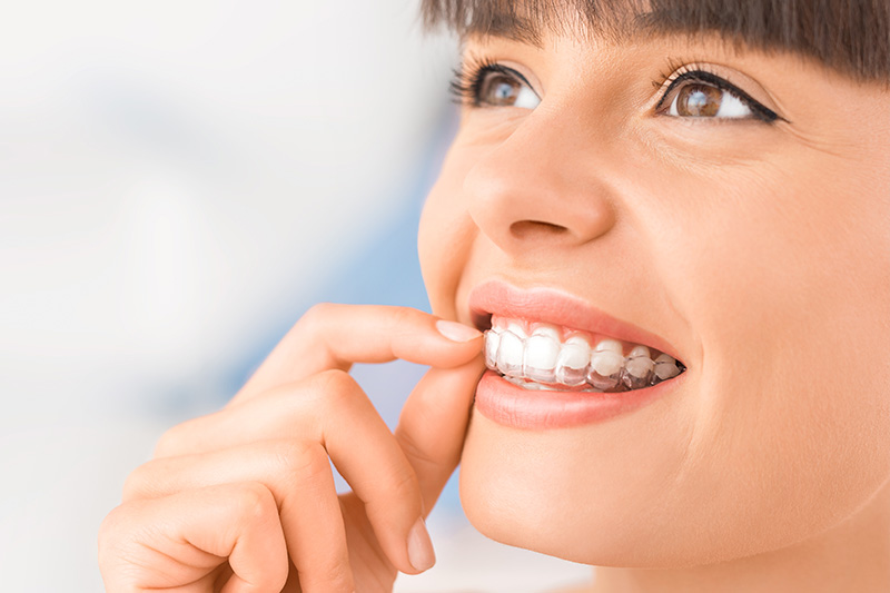 Invisalign in Woodland Hills